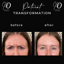 XO Aesthetic Refinery