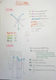 Ecg Lead Summary Ekg Bullet Journal Medicine