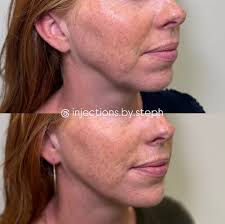 Stephanie Lemmon MS, PAC (@injections.by.steph) • Instagram photos and  videos