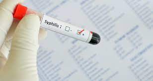 Syphilis Eine Krankheit Die Oft Unentdeckt Bleibt Docmorris Blog