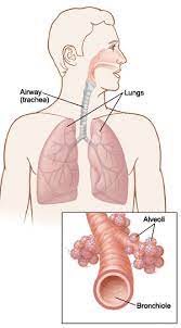 Conclusions antiviral treatment for severe influenza is associated with reduced mortality and improved clinical outcomes. Influenza Adult