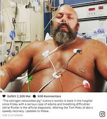 Tom stoltman grew up in invergordon, and was diagnosed with autism at the age of five. Big Lenny Mit Herzproblemen Im Krankenhaus Gannikus De