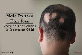 It may sound strange but lifestyle factors such as diet, smoking and stress can cause hair loss. Male Pattern Hair Loss Knowing The Causes Treatment Of It By Dr Ankuja Mhaske Lybrate