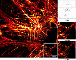 Object detection has been around for quite a while; Super Resolution Microscopy Wikipedia