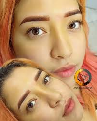 Ananateramicropigmentacion