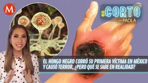 En colaboración con luis cárdenas, para mvs noticias, platicamos con arturo barba, colaborador de ciencia, quien habló sobre ¿qué es la infección de hongo negro? Milenio Hongo Negro Cobro Su Primera Victima En Mexico Pero Que Se Sabe En Verdad Sobre La Enfermedad Facebook