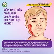 VIÊM TINH HOÀN DO QUAI BỊ