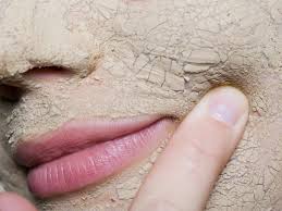 Image result for Dry Skin