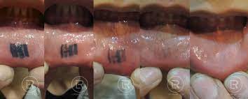 How Much Would An Inner Lip Tattoo Cost