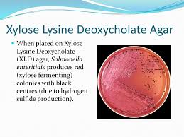 Xylose lysine deoxycholate agar (xld agar) is a selective growth medium used in the isolation of salmonella and shigella species from clinical samples and from food.12 it has a ph of approximately 7.4, leaving it with a bright pink or red appearance due to. Pathology 417 Case 1 Microbiology Laboratory Ppt Download