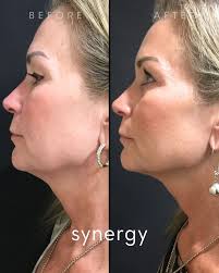 Synergy Face + Body added a new photo.