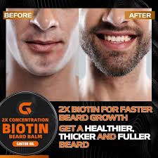 Amazon.com : Beard Balm with 2X Concentration Biotin, Beard Growth Balm for  Men