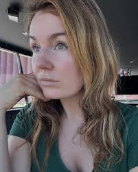 After many many questions: This is how my skin looks now 2.5 week post  fractional laser treatment with skin booster by @huidklinieksneek.nl .  Picture 1 and 2 directly after treatment 3 and