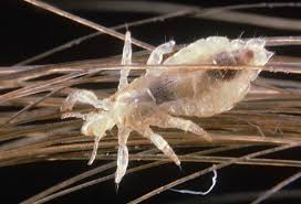 Head Lice What Parents Should Know Louse Lice Pictures Head Lice Infestation