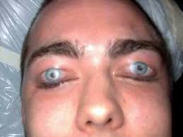 ÎÏÎ¿ÏÎ­Î»ÎµÏÎ¼Î± ÎµÎ¹ÎºÏÎ½Î±Ï Î³Î¹Î± worst tattoos