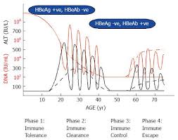 Natural History Of Chronic Hepatitis B Phases In A Complex