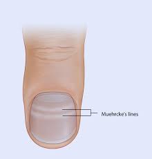 Image result for Mees Line