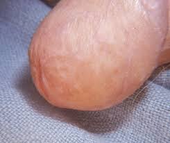 (sometimes the silly phrase, if it looks like ringworm, it isn't. Not All Round Rashes Are Ringworm A Differential Diagnosis Of Annular And Nummular Lesions 2018 10 18 Relias Media Continuing Medical Education Publishing