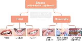$19.95 per month and it saves everyone in the household up to 80% off dental/vision/rx and chiropractic care. Braces Cost In Malaysia Top 5 Things To Know Tan Dental Surgery