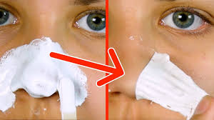 Mitesser sind kleine schwarze oder gelbe beulen auf der haut. Ziehe Hassliche Mitesser Mit Simplem Hausmittel Einfach Ab Es Funktioniert Sofort Youtube