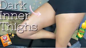 Apply a thin layer to the inner thighs, like you would a face or body mask. How To Lighten Dark Inner Thighs Fast Naturally Causes Products Remedies To Lighten Inner Thighs Youtube