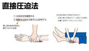 止血 直接圧迫法 楽しい豆知識 医療 幸せ 名言