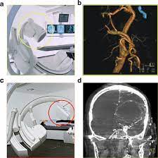 640 channels x 16 elements. Flat Detector Computed Tomography Fd Ct Springerlink
