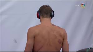 Maybe you would like to learn more about one of these? Michael Phelps Hat Vom Schropfen Rote Kreise Auf Seinem Rucken Business Insider