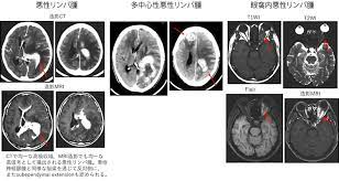 ばさん リベンジポルノ マジックミラー ヘンリー塚本 友達のお母さん ライブチャット 流出 美少女 痴漢 本物レイプ アナル 無理やり中出し エロアニメ 熟. è„³ç¥žçµŒå¤–ç§'ã®ç—…æ°— æ‚ªæ€§ãƒªãƒ³ãƒ'è…« ç—…æ°—ã®æ²»ç™‚ å¾³æ´²ä¼šã‚°ãƒ«ãƒ¼ãƒ—