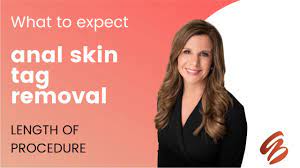 Anal Skin Tag Removal - Amy Brenner, MD & Associates