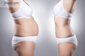 Hcg Diet Weight Loss Queens Ny Hcg Weight Loss Queens Hcg Diet Ny Forest Hill Hcg Weight Loss Hcg Weight Loss 11375 Hcg Weight Loss 11374