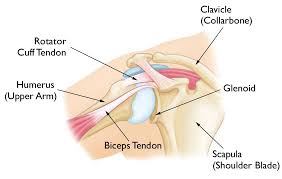 Surgery for frozen shoulder