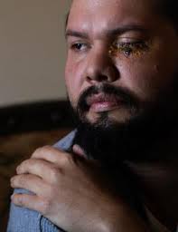 At Southbury Training School, Campus Fire, Medical Response Comes With A  High Price Tag