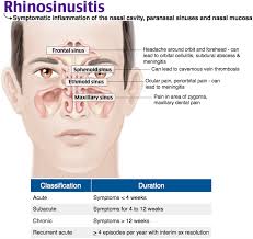 Rhinosinusitis Pediatric Nurse Practitioner Dentistry Family Nurse Practitioner