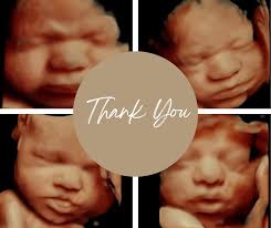 Image result for tbn:T5UajvfpShvp6M::www.photoslinks.com/index.php%3Foption%3Dcom_joomgallery%26func%3Dwatermark%26catid%3D4%26id%3D23%26Itemid%3D2