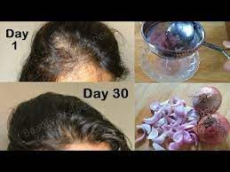 Here are 10 benefits and uses that'll leave your hair nourished and soft. Pin On Projects To Try