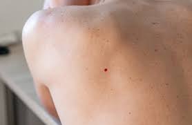 Where Do Red Moles Come From The Active Times