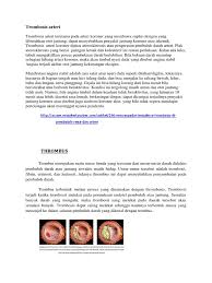 Thrombosis is the process of a blood clot, also known as a thrombus, forming in a blood vessel. Trombosis Arteri