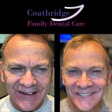 What is a Dental Implant?