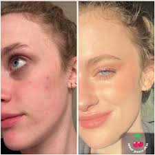 TAY🍒 Advanced Holistic Facialist SLC, UT (@innerpeaceskin) • Instagram  photos and videos