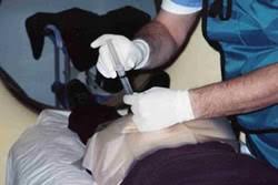 Image result for Pudendal Block