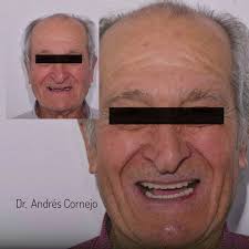 Dr. Andrés Cornejo Rehabilitación Oral y Estética