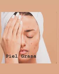 DERMATOCOSMIATRIA : GLORIA CARRERA🧖‍♀️ (@loly_carresqui) • Instagram  photos and videos