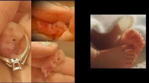 Plasenta adalah organ yang menyediakan oksigen dan nutrisi dari ibu bagi bayi untuk melakukan pertumbuhan dan perkembangan dalam kandungan. Ibu Hamil Masih Ragu Puasa Tenang Janin Di Dalam Perut Tidak Akan Kelaparan Tribunnews Com Mobile