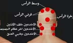 فوائد الحجامة في وسط الرأس مركز وقاية للحجامة بالكويت الحجامة بالكويت حجام بالكويت