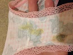 Check spelling or type a new query. Yellow Discharge Tmi Pic