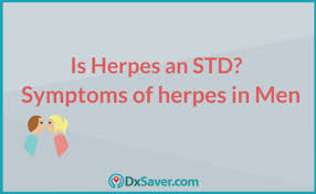 Detects antibodies the body produces in response to herpes. Is Herpes An Std Herpes Symptoms In Men Herpes Testing Just At 55