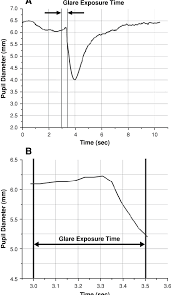 Change In Pupil Diameter Measured With A Ccd Camera In An