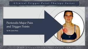 Pectoralis major rupture has never been reported in the literature in a woman in this age group. Pectoralis Major Pain And Trigger Points Youtube