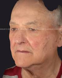 Chaque peau raconte une histoire — encore faut-il savoir bien l'écouter.  Dre Brassard revient sur une situation mal diagnostiquée, et explique  comment un œil expert et une bonne écoute peuvent tout changer.